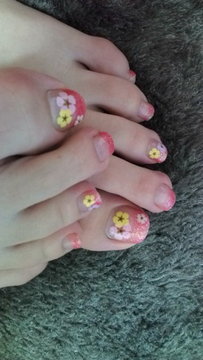 Resort nail