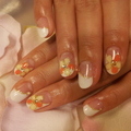 flower nail