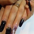 ロングスカルプ