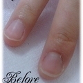 ケア　*－Ｂｅｆｏｒｅ－*